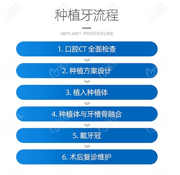 口腔种植牙的流程