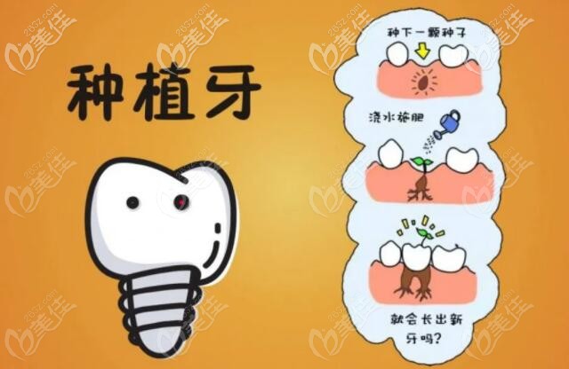 那啥叫种植牙