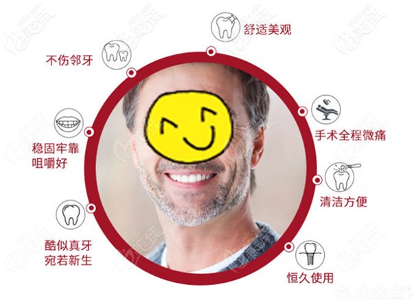 种植牙优势 种植牙优势