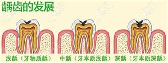 下载.jpg