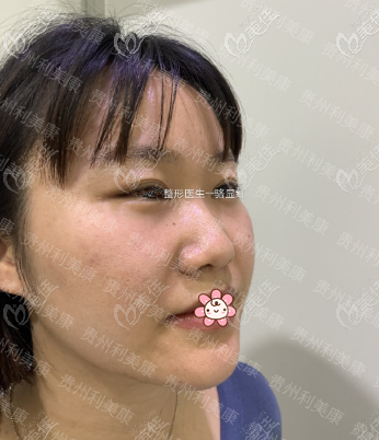 侧面更塌 侧面更塌