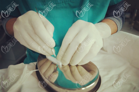 刘医生在雕刻假体形状 刘医生在雕刻假体形状