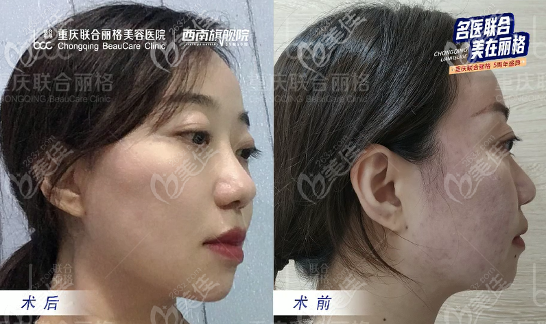 侧面效果也很明显