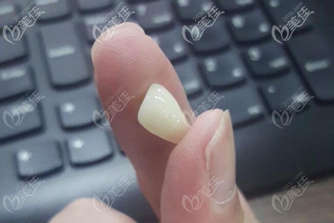 二氧化锆全瓷牙