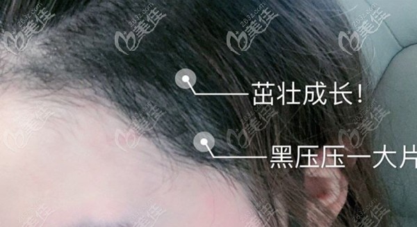 额角种植1800单位效果 额角种植1800单位效果