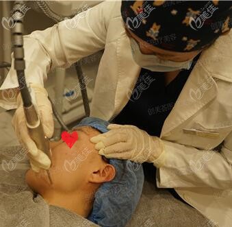 欧洲之星fotona4d面部提升过程中