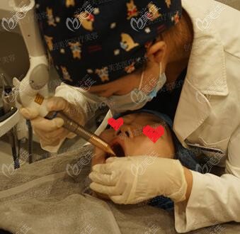 欧洲之星fotona4d面部提升口内激光治疗