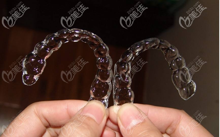 温州正畸医院价目表