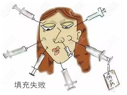 注射玻尿酸填充失败