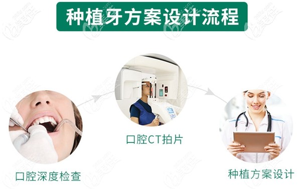 种植牙方案设计流程 种植牙方案设计流程