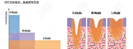 菲蜜丽的脉宽可以灵活调节 菲蜜丽的脉宽可以灵活调节
