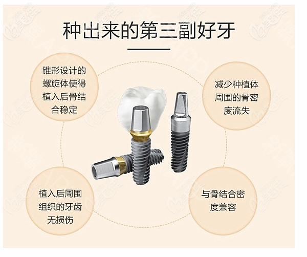大连牙元素口腔的种植牙帮你种植