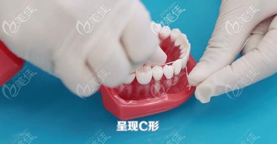 牙线使用方法第三步