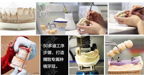 长春超龙牙博士即刻美学修复