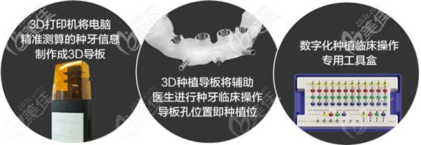 3D种植导板可准确掌控种牙位置