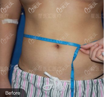 北京如朵医疗美容门诊部季一发术前照片1