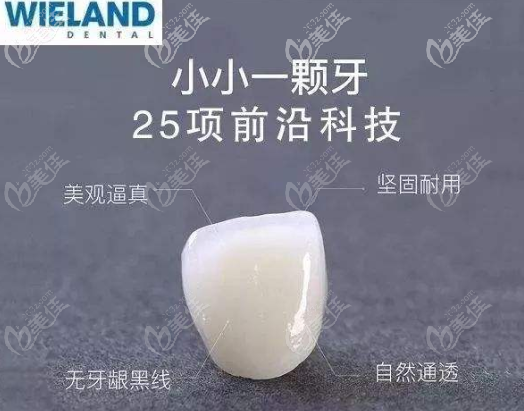 德国威兰德 德国威兰德