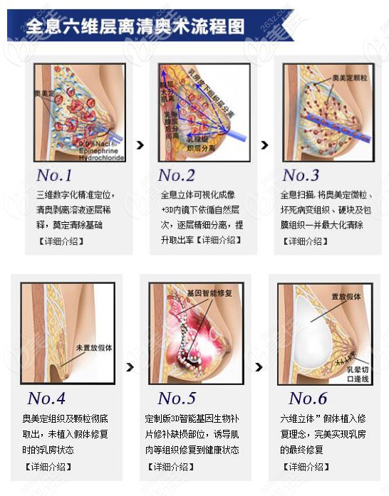 全息六维层离清奥术流程图片