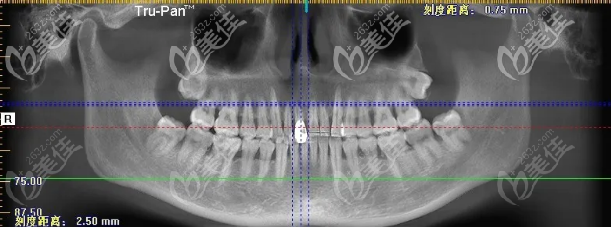 当时拍的片子 当时拍的片子