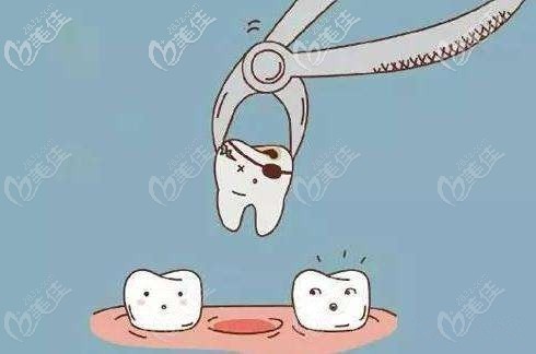 牙齿矫正要拔牙吗 牙齿矫正要拔牙吗