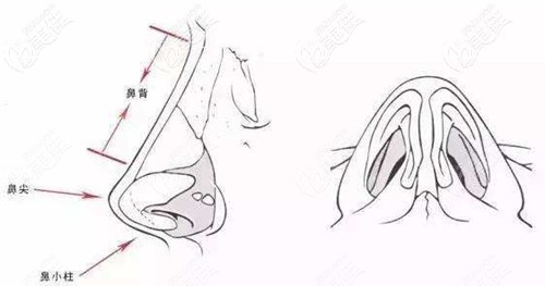 王广东医生隆鼻优势