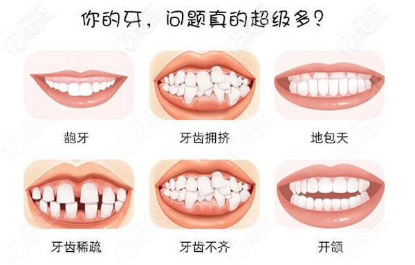 该做牙齿矫正的牙齿问题
