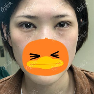 在福州格莱美手术当天