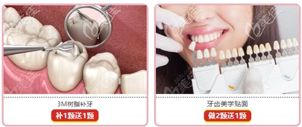 石家庄中诺口腔3M树脂补牙和牙齿贴面的优惠