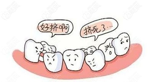 儿童牙齿问题需要矫正