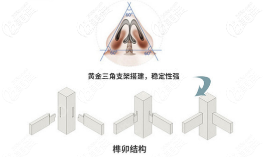 三角支架结构搭建鼻部形态