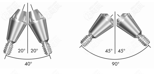 瑞典astra种植体