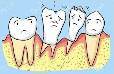 什么是牙周炎