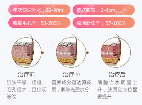 青春解码仪的治疗效果 青春解码仪的治疗效果