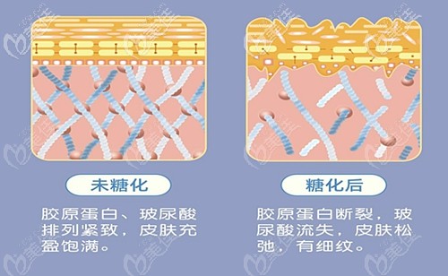 皮肤糖化和未糖化的区别