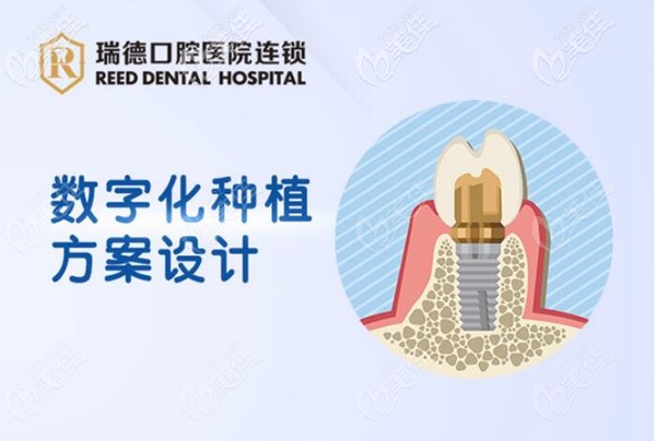 广州瑞德口腔医院种植牙价格表