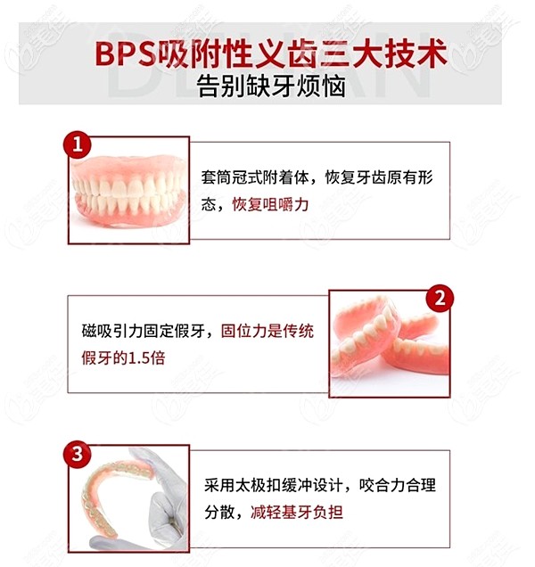 北京国贸佳美口腔做吸附性义齿的优势 北京国贸佳美口腔做吸附性义齿的优势