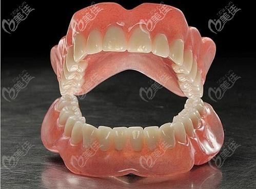 佳美口腔BPS全口吸附性义齿的图片 佳美口腔BPS全口吸附性义齿的图片
