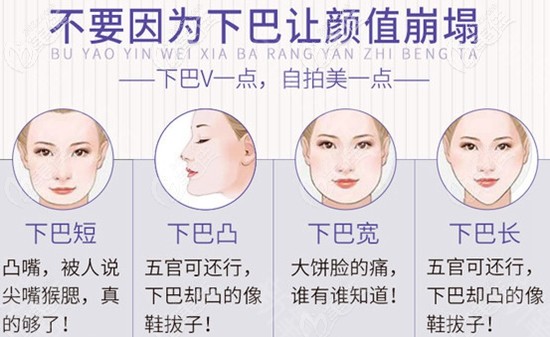 买它买它!广州韩后整形韩式生科隆下巴6800元起的价格真是优惠到心坎里了!