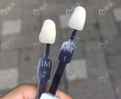 瓷贴面1m2,1m1色号图 瓷贴面1m2,1m1色号图