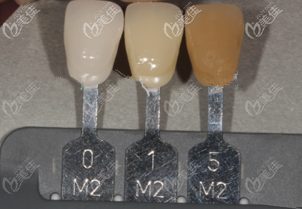 牙齿0m2颜色图 牙齿0m2颜色图