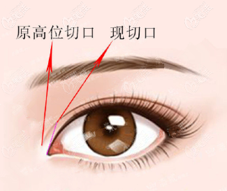 切口位置 切口位置