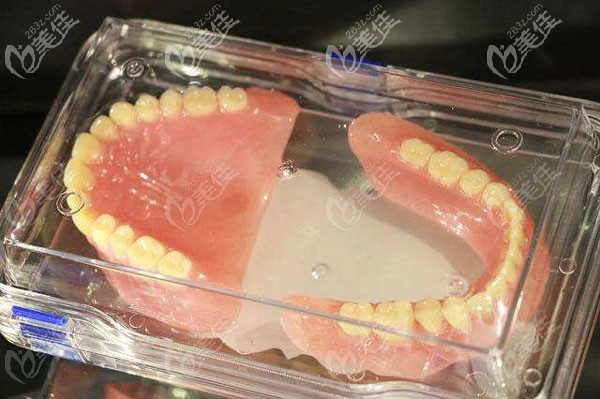 吸附性义齿价格是多少