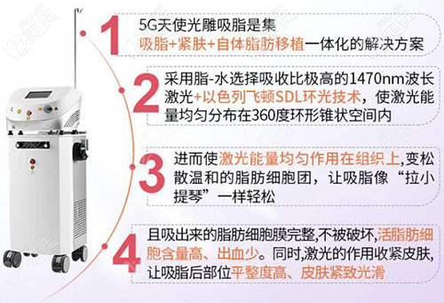 5G天使光雕吸脂优势 5G天使光雕吸脂优势