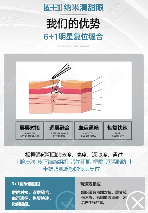成都东篱医院6+1纳米清甜眼技术优势 成都东篱医院6+1纳米清甜眼技术优势