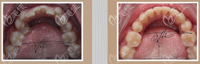 前后对比是不是很明显呢 前后对比是不是很明显呢