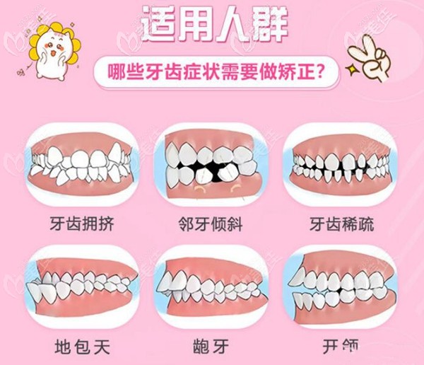 广州穗江矫正牙齿范围