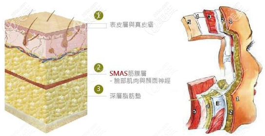 PSV面部提升层次示意图