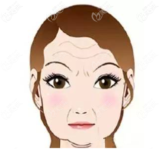 松弛的面部肌肤示意图