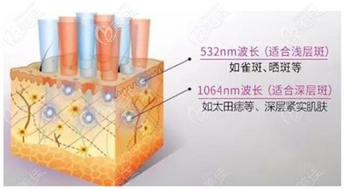 超皮秒波长的选择