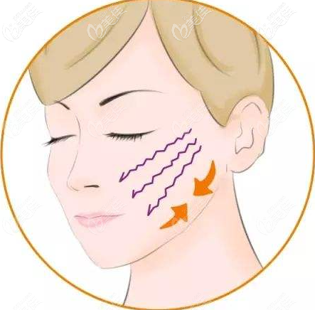 v美减龄v3是怎样做的